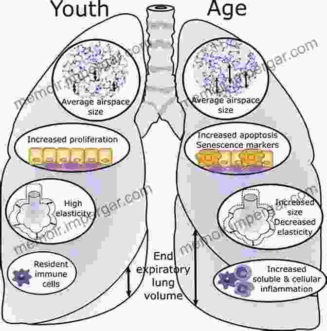 Age Related Changes In Lung Function Molecular Aspects Of Aging: Understanding Lung Aging