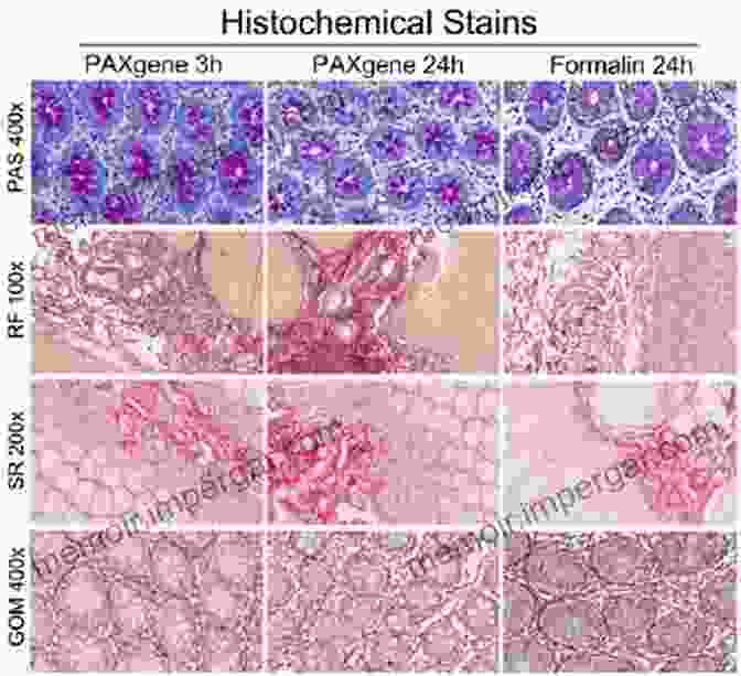 Histochemical Staining Of Human Tissue, Revealing The Distribution Of Specific Molecules. The Mesonephros Of Cat And Sheep: Comparative Morphological And Histochemical Studies (Advances In Anatomy Embryology And Cell Biology)