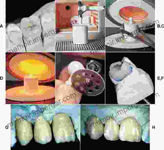 Image Of Dental Materials And Techniques Quintessence Of Dental Technology 2024: Volume 42