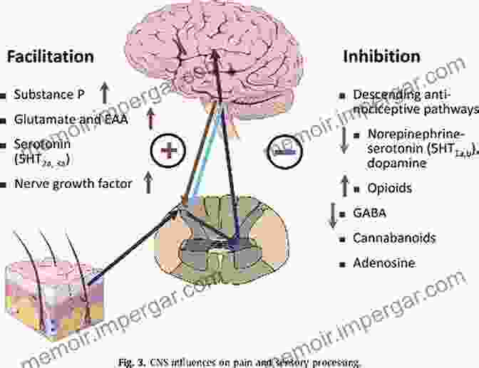 Mechanisms Of Chronic Musculoskeletal Pain Musculoskeletal Pain: Basic Mechanisms Implications