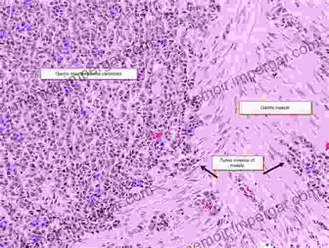 Microscopic Image Of Cellular Pathology In An Animal Tissue General Pathology For Veterinary Nurses