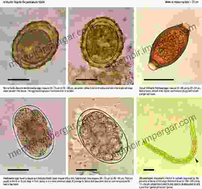 Microscopic Images Of Various Parasites, Showcasing Their Diversity In Size, Shape, And Structure. Advances In Parasitology (ISSN 60)