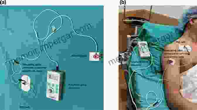 Peripheral Nerve Stimulation Progress In Neurological Surgery 24 Peripheral Nerve Stimulation (Progress In Neurological Surgery 24)