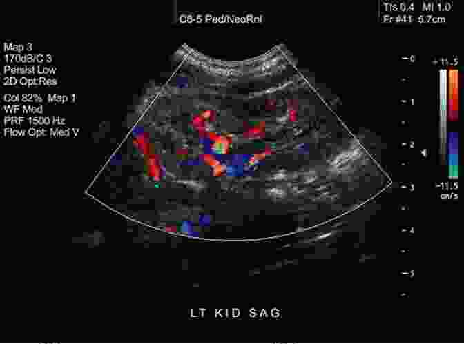 Ultrasound Image Interpretation Clinical Ultrasound: A How To Guide