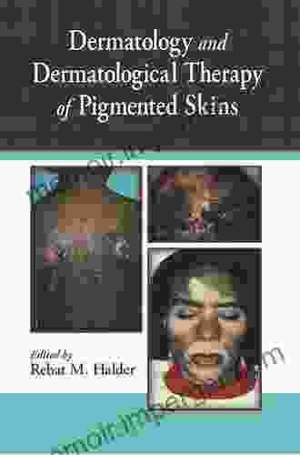 Dermatology And Dermatological Therapy Of Pigmented Skins