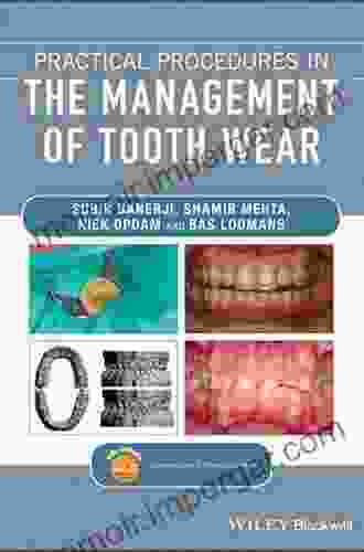 Practical Procedures in the Management of Tooth Wear