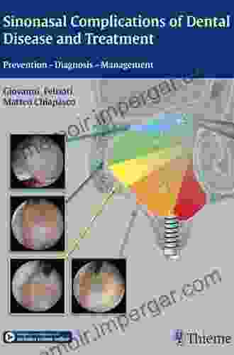 Sinonasal Complications Of Dental Disease And Treatment: Prevention Diagnosis Management