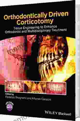 Orthodontically Driven Corticotomy: Tissue Engineering to Enhance Orthodontic and Multidisciplinary Treatment