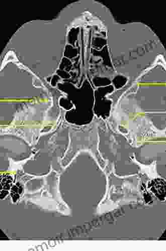 Skull Base Imaging